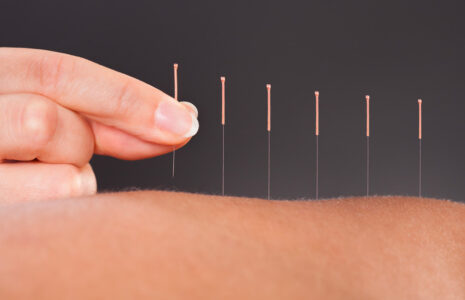 L’Association des acupuncteurs du Québec s’affilie à la Fédération des professionnèles–CSN